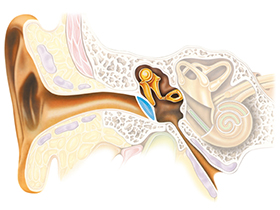 pérdida auditiva conductiva